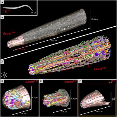 Structural Analysis of the Caenorhabditis elegans Dauer Larval Anterior Sensilla by Focused Ion Beam-Scanning Electron Microscopy